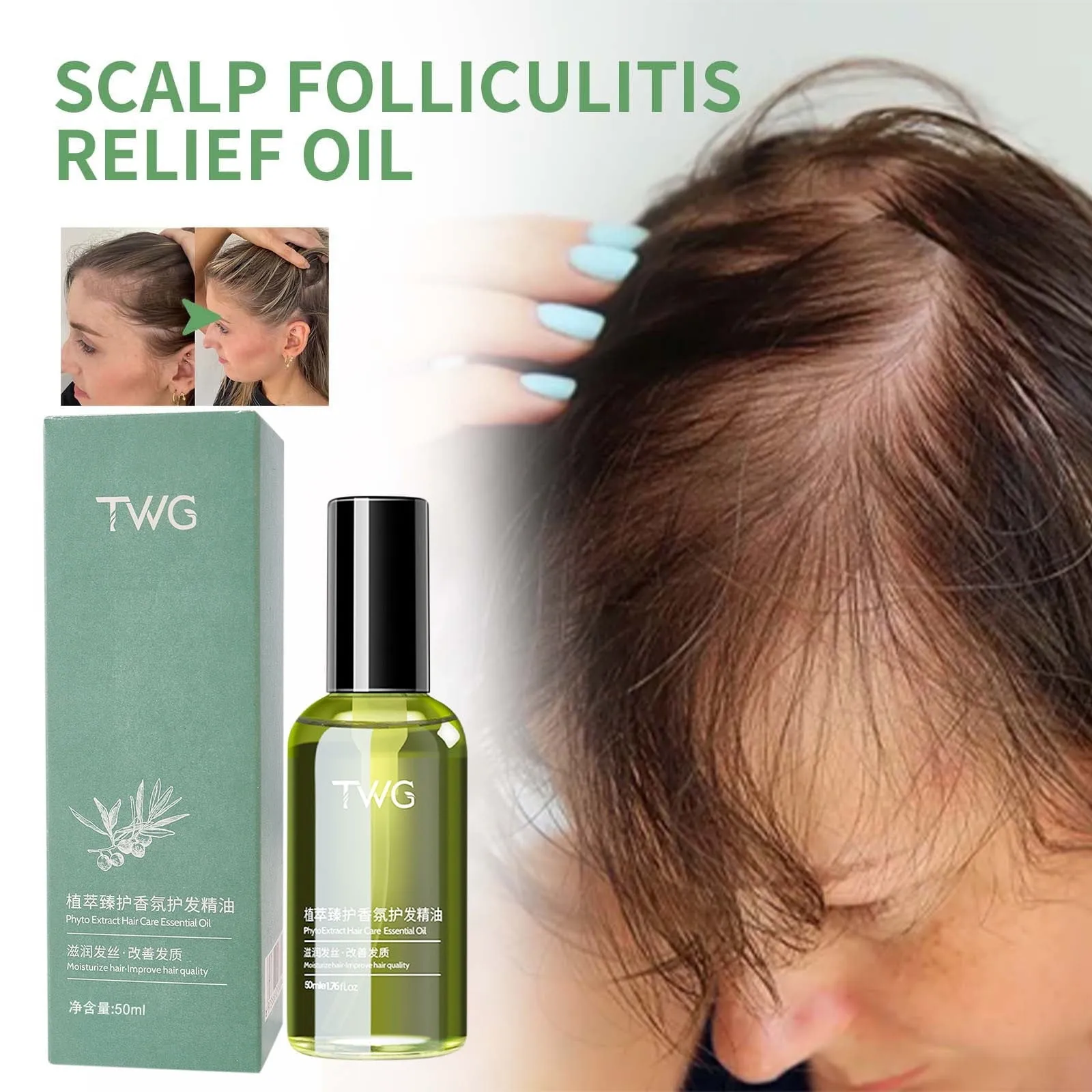 Scalp Repair Essential Oil Relieves Redness And Itching Of Scalp 50ml